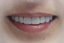 sonrisa-final-real