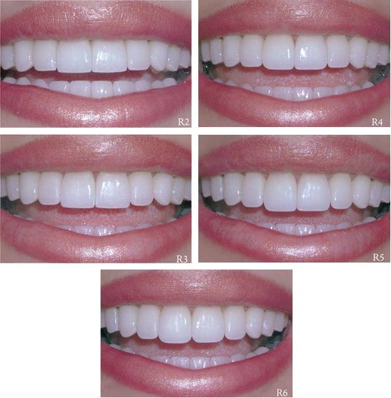 sonrisas