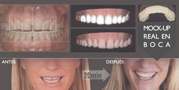 diseño-de-sonrisas