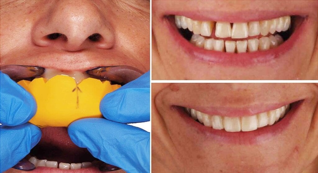 estetica-dental