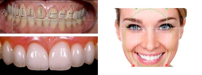 sonrisas-digiales-funcionamiento