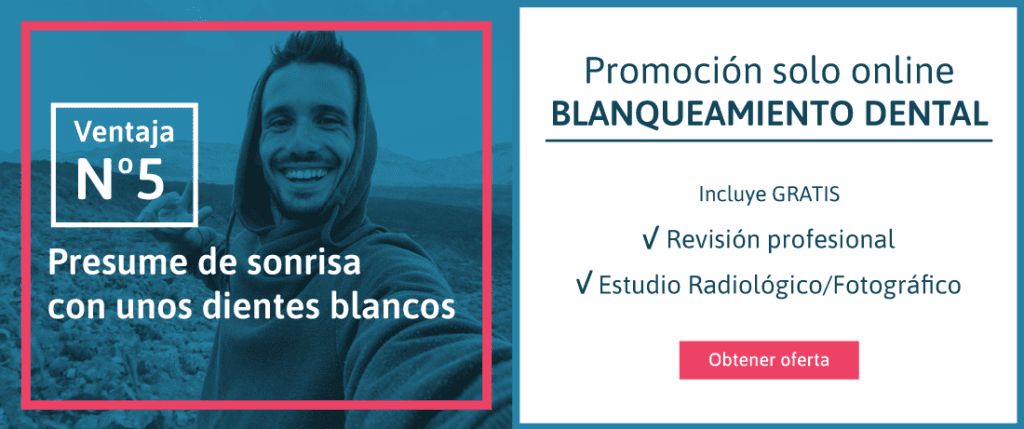 blanqueamiento-dental