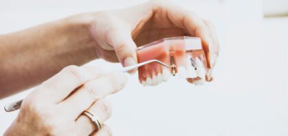 Clínica especializada en implantes dentales