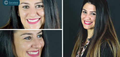 cambiar-la-sonrisa_Dental-Carralero