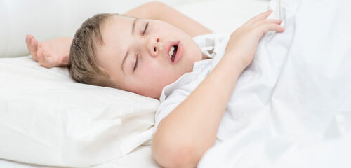 apnea del sueño infantil