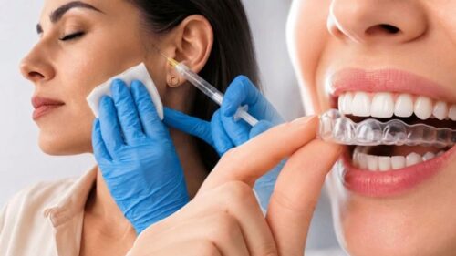 tratamientos para el desgaste dental por bruxismo