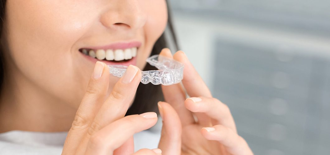 cómo funciona Invisalign