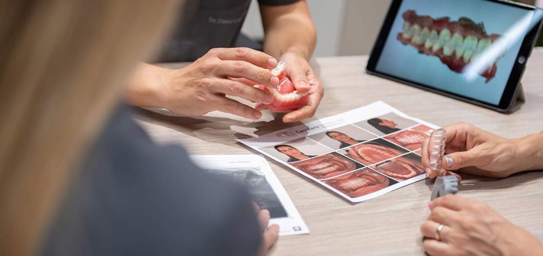 alineadores Invisalign