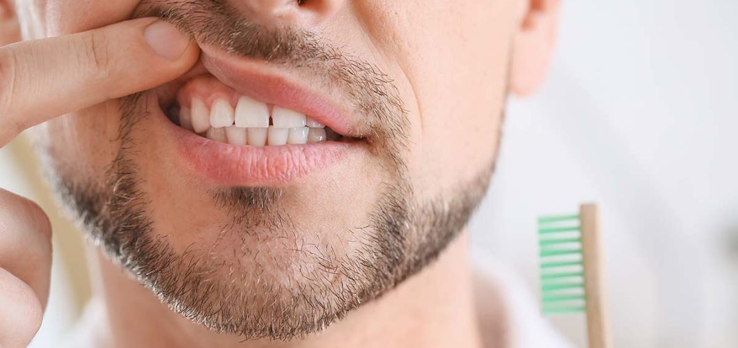 tratamiento periodontal