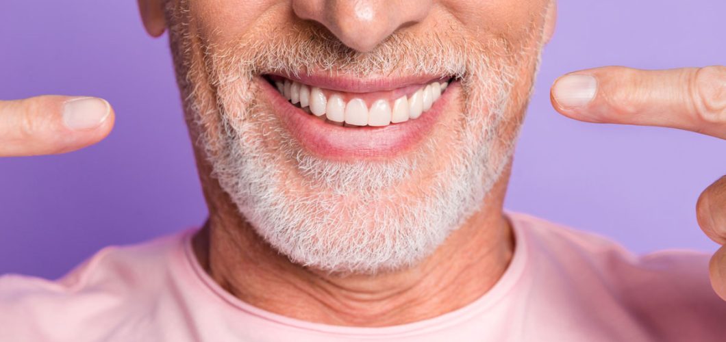 implantes dentales sin cirugía