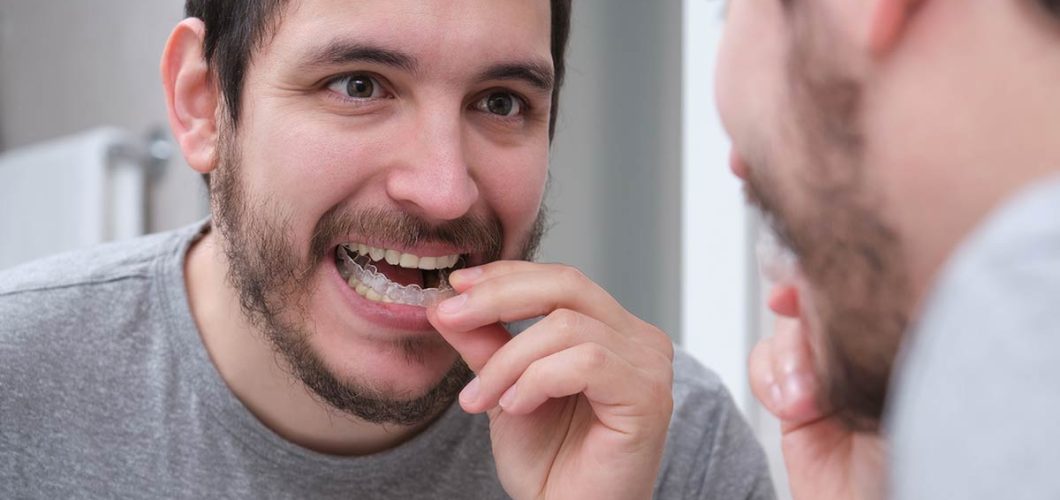 resultados de la ortodoncia invisible