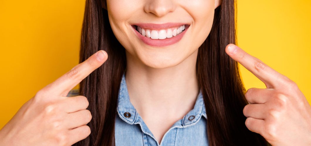 diseño de sonrisas