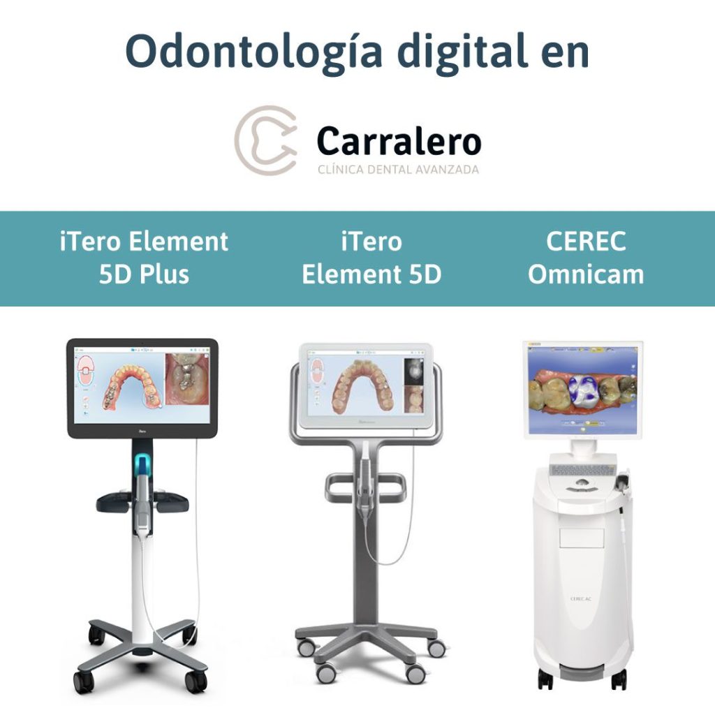 escáneres intraorales_Dental Carralero
