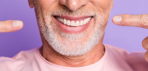 implantes dentales sin cirugía